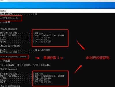 Windows10开机设置为DHCP的教程（一步步教你如何在Windows10上将开机设置为DHCP，轻松连接网络）